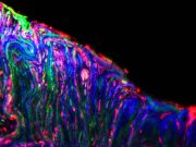 Микробы выращиваются на матрицах?