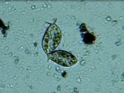 Определяем уровень загрязнения воды с помощью смартфонов