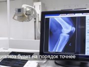 Google и Bayer анонсировали ИИ-платформу для рентгенологов