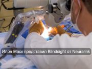 Вживляемое устройство вернёт слепым зрение с графикой 8-битных игр