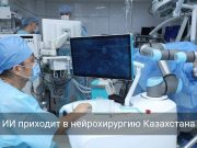 В Караганде робот впервые будет проводить нейрохирургические операции