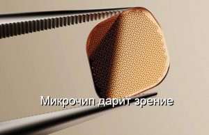Имплант сетчатки для восстановления зрения получил одобрение к использованию в Европе Home