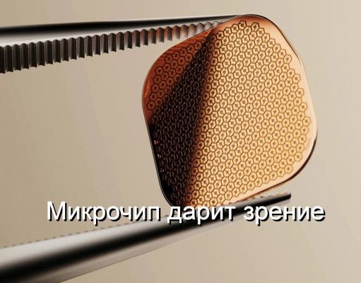 Имплант сетчатки для восстановления зрения получил одобрение к использованию в Европе